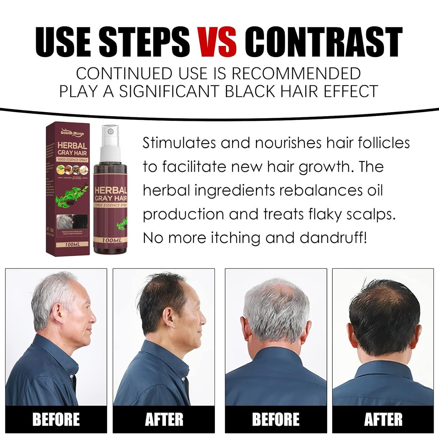 PROBLEND Herbal Anti-Grey Hair Permanent Spray | Restores Melanin Production & Ensures Natural Hair Darkening - 100mls