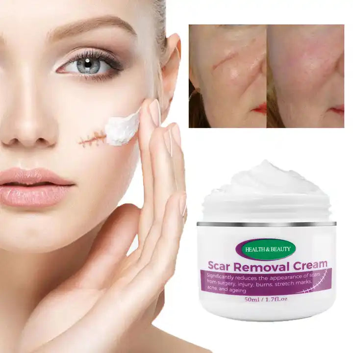 Scars & Stretch Marks Removal Cream