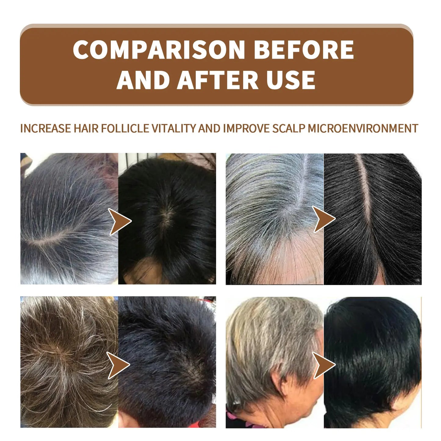 PROBLEND Herbal Anti-Grey Hair Permanent Spray | Restores Melanin Production & Ensures Natural Hair Darkening - 100mls