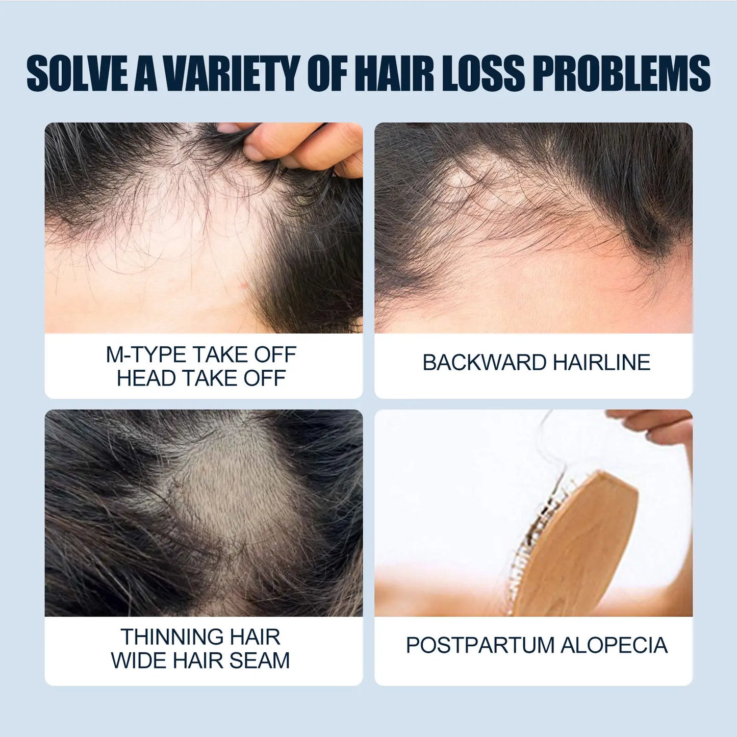 Scalp Care Hair Growth Spray - Anti-Shedding & Hair Regrowth Treatment for Men & Women