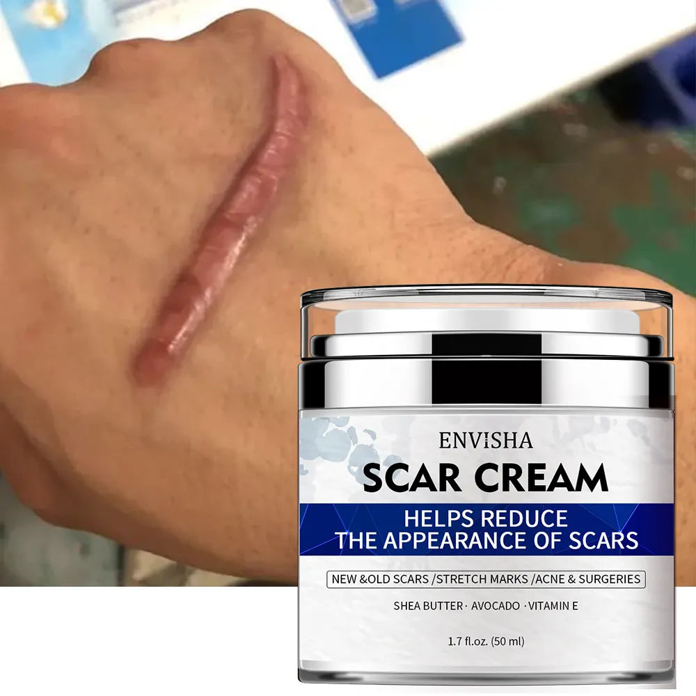 Scar Removal Cream - Advanced Scar Treatment Cream for Surgical Scars, Acne Scars, C-Section, Burns, Stretch Marks - for Old and New Scars