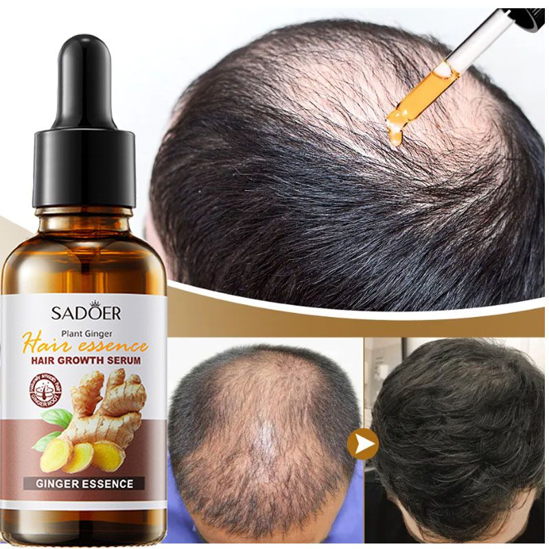 Ginger Magic Hair Treatment & Growth Serum ( BUY 1 GET 1 FREE )
