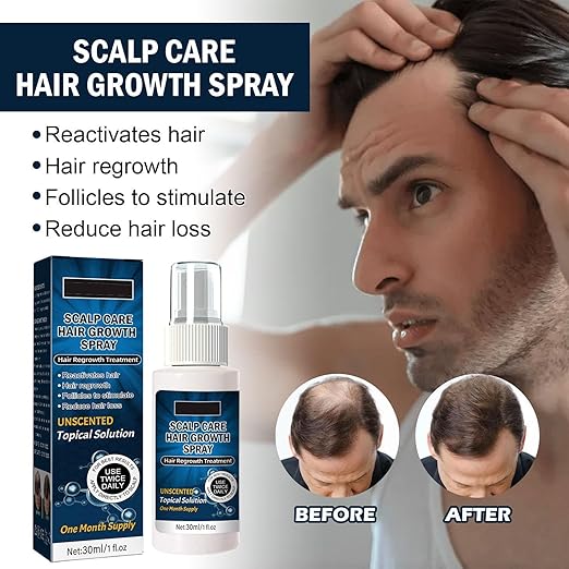 Scalp Care Hair Growth Spray - Anti-Shedding & Hair Regrowth Treatment for Men & Women