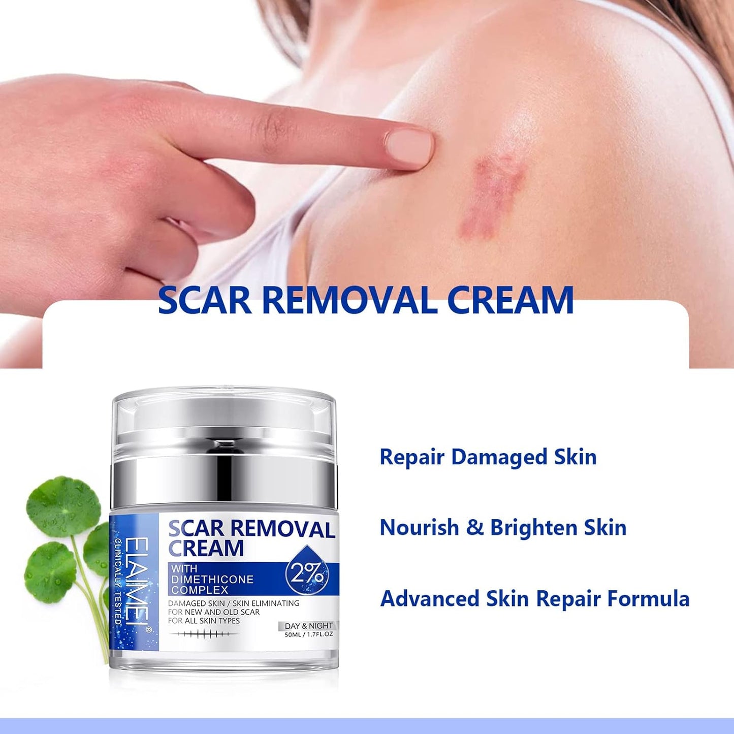 Scar Removal Cream - Advanced Scar Treatment Cream for Surgical Scars, Acne Scars, C-Section, Burns, Stretch Marks - for Old and New Scars