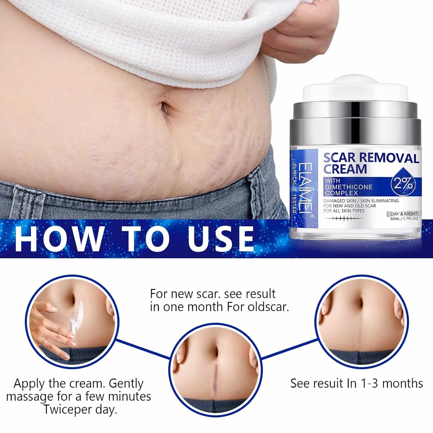 Scar Removal Cream - Advanced Scar Treatment Cream for Surgical Scars, Acne Scars, C-Section, Burns, Stretch Marks - for Old and New Scars